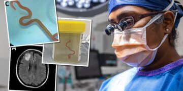 Bir insanda görülen ilk vaka: Canberra’da bir hastanın beyninden canlı solucan çıkarıldı