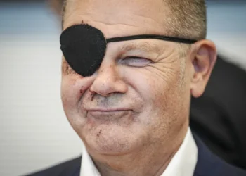 Alman Başbakan Olaf Scholz, yaralı olduğu fotoğrafı paylaştı