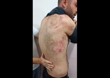 Muş’ta jandarmadan Muhammed Erol’a işkence: 6 saat işkence ettiler, kımıldayamıyorum