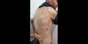 Muş’ta jandarmadan Muhammed Erol’a işkence: 6 saat işkence ettiler, kımıldayamıyorum