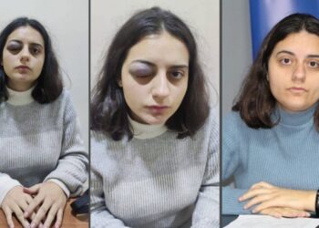 HEDEP’li İbrahimoğlu, polis şiddetini anlattı: Atkı ile boğmaya çalıştı, başımı araca vurdu