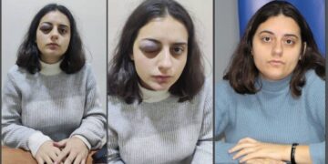 HEDEP’li İbrahimoğlu, polis şiddetini anlattı: Atkı ile boğmaya çalıştı, başımı araca vurdu