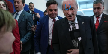 Günler sonra oy kullanmak için ortaya çıkan Bahçeli’nin yüzündeki morluklar dikkat çekti
