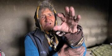 Cumhur ittifakı ortağı Bahçeli’nin memleketinde dram: 71 yaşındaki  kadının yaşam mücadelesi