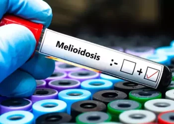 Queensland’de melioidoz hastalığı nedeniyle  31 kisi hayatını kaybetti