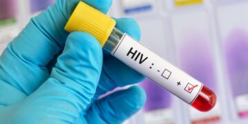 Avustralya bilim insanlarından, HIV tedavisinde tarihi adım: Virüs hücre içinde görünür hâle getirildi