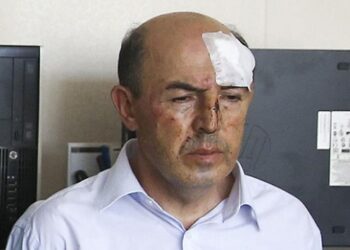 Ankara Başsavcılığı eski Korgenerale işkenceyi görmedi: AA’nın görüntülerine rağmen takipsizlik