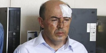 Ankara Başsavcılığı eski Korgenerale işkenceyi görmedi: AA’nın görüntülerine rağmen takipsizlik