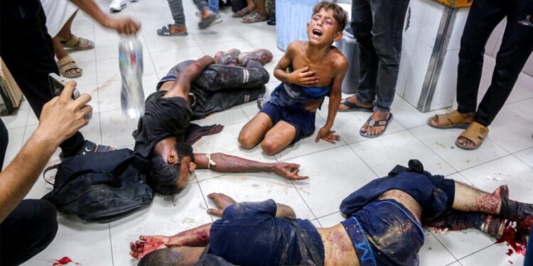 EDITORS NOTE: Graphic content / An injured boy reacts as he sits on the ground by other men who were all wounded while previously queueing for aid, at Nasser Medical Complex in Khan Yunis in the southern Gaza Strip on July 20, 2025. (Photo by AFP)