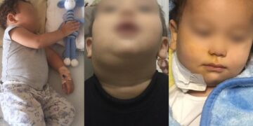 Sürekli verem tedavisi gören Selman’ın anne-babası tutuklandı