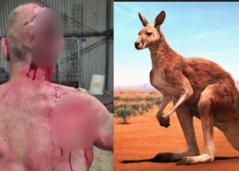 VİCTORİA’DA KANGURU SALDIRISI: ÇİFTÇİ AĞIR YARALANDI