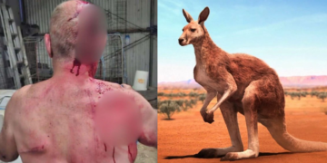 VİCTORİA’DA KANGURU SALDIRISI: ÇİFTÇİ AĞIR YARALANDI