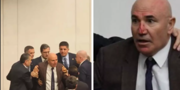 AKP’lilerin saldırısında burnu kırılan Mahmut Tanal hastaneye kaldırıldı